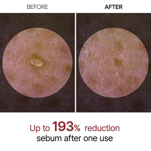 Dr.Melaxin Official] Peel Shot Glow Rice Ampoule Duo - Serums for Brightening, Exfoliating, and Moisturizing - Suitable for All Skin Types - Image 3
