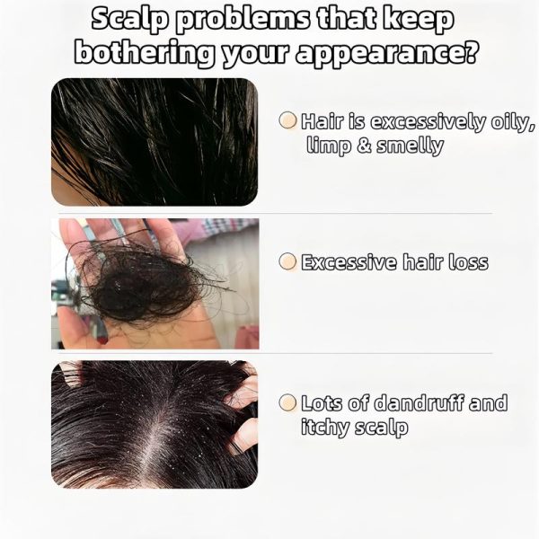 【Buy 1 Get 1 Free】REMIMPI Anti-Hair Fall Hair Loss Treatment Shampoo Oil Control Anti dandruff Haircare Ginseng Ginger Help Hair Growth Jojoba Oat Repair Reduce Hair Loss Scalp Cleanser Conditioner300ML - Image 3